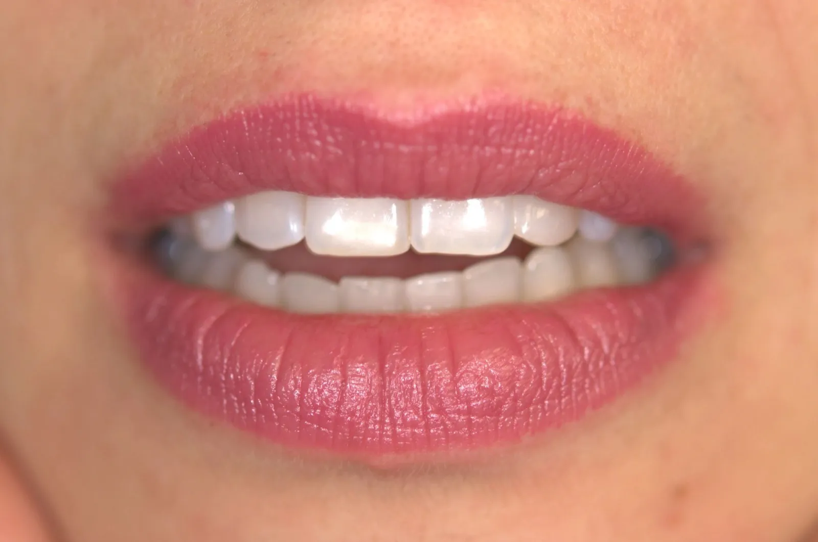Клиника Carp Dent